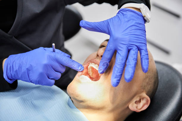 Best Emergency Wisdom Teeth Removal in Waggaman, LA