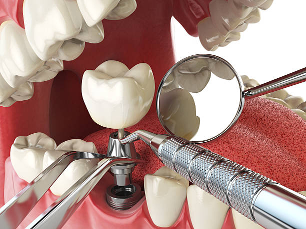 Reliable LA Emergency Dentist Solutions